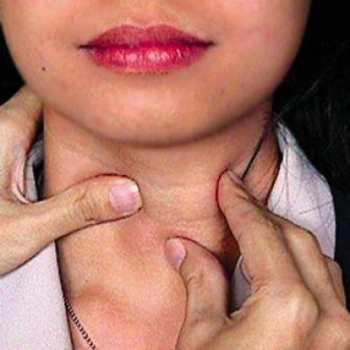 Заболевания щитовидной железы - женщины в группе риска
